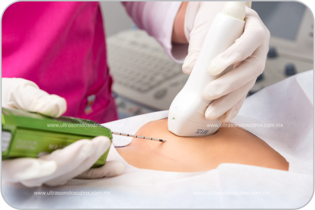 Toma de biopsias en la cdmx Toma de biopsias e infiltraciones articulares en la cdmx