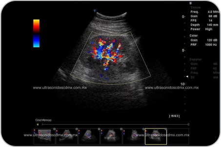 Ultrasonido doppler mamario en la cdmx Ultrasonido doppler mamario en la cdmx