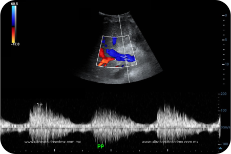 Ultrasonido obstétrico doppler en la cdmx Ultrasonido obstétrico doppler en la cdmx